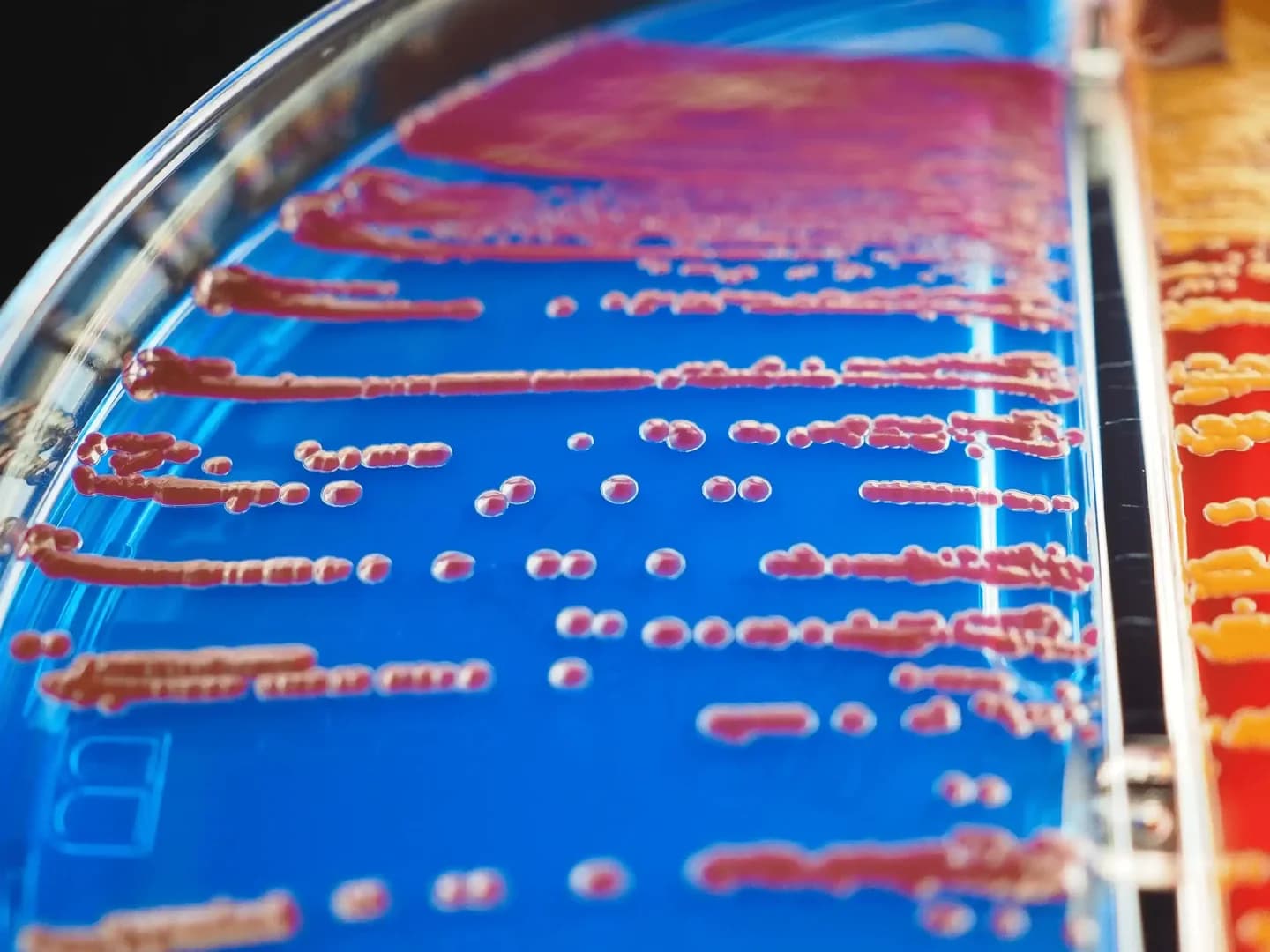 Mikrobiologi / Microbiology